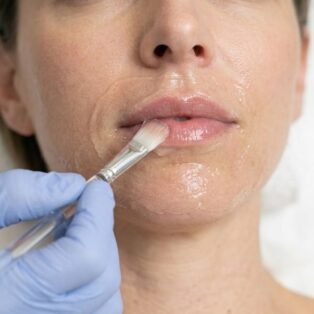 Lip Peel banner