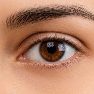Under Eye Peel banner